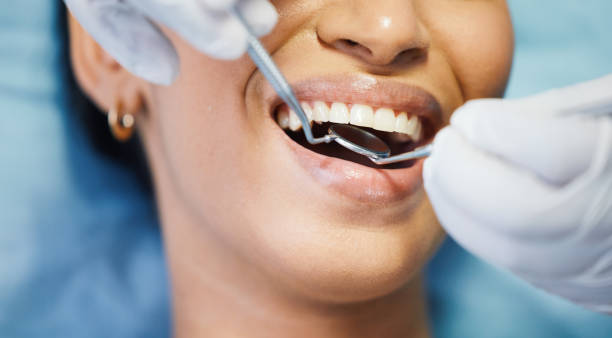 Best Urgent Care for Lost Fillings or Crowns in Fullerton, CA